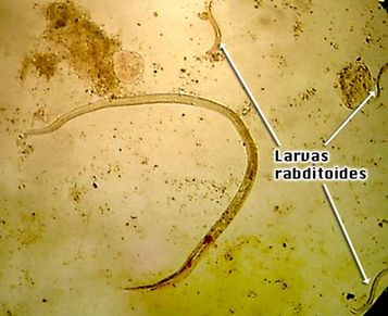 huevo de estrongiloide