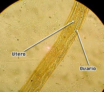 huevo de estrongiloide