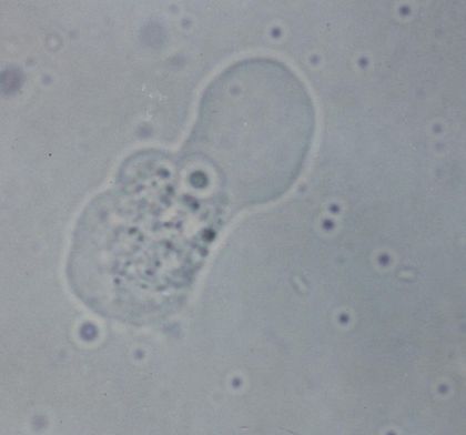 trofozoíto naegleria fowleri