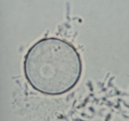 trofozoíto naegleria fowleri