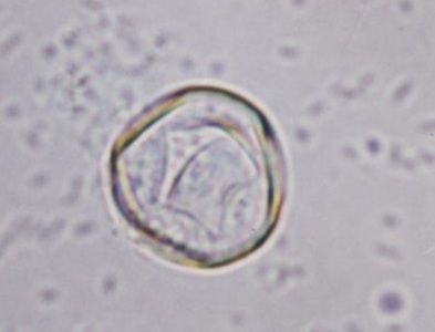 trofozoíto naegleria fowleri