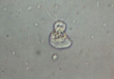 trofozoíto naegleria fowleri