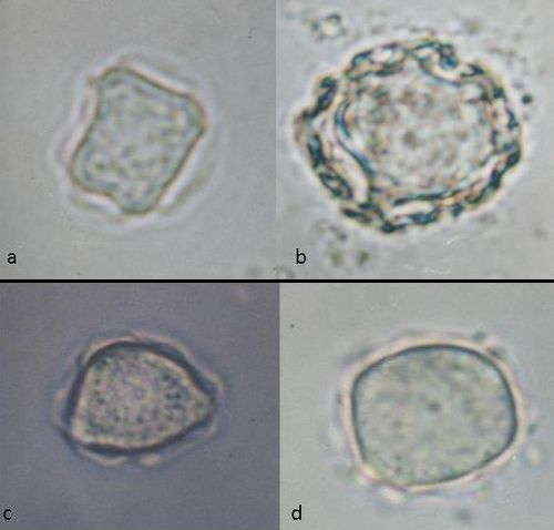 ciclo de vida de la acanthamoeba